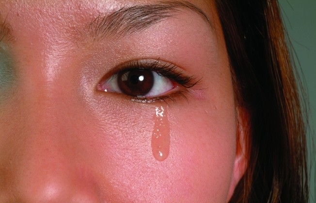 眼睛迎风流泪可分为冷泪和热泪两种类型:        1,冷泪:眼睛不